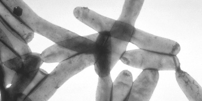 Legionellen sind Bakterien, die in Wasserleitungen vorkommen und schwere Atemwegsinfektionen auslösen können, wenn sie als feiner Wassernebel (Aerosole) eingeatmet werden.