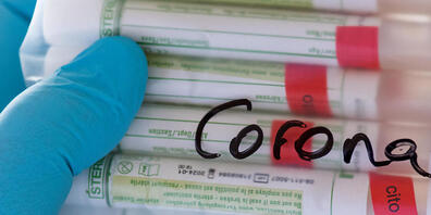 Der Kanton liess alle Mitarbeitenden und alle Patientinnen und Patienten der Rehaklinik Braunwald auf eine Infektion mit dem Corona-Virus testen. (Symbolbild)