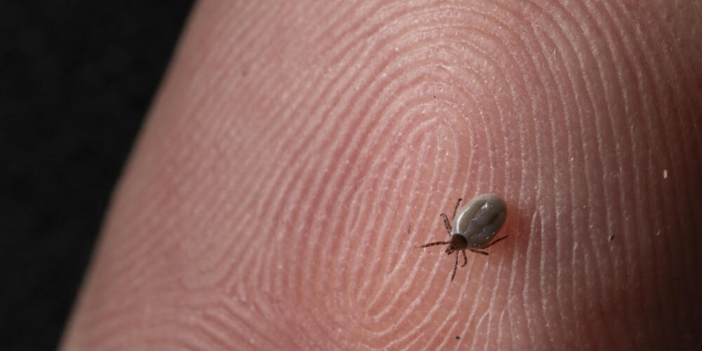 Sie sind klein und verbreiten Unbehagen: eine Zecke auf dem Finger einer Person. (Archivbild)
