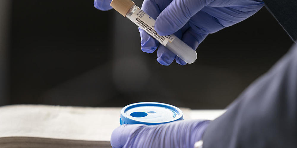 Der Bund schlägt den Kantonen wegen des Coronavirus ein Testobligatorium für Gesundheitsfachleute vor. (Symbolbild)