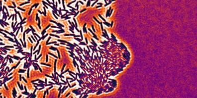 Eine wandernde Kolonie von Pseudomonas aeruginosa-Zellen. Pseudomonas ist ein berüchtigter, äusserst schwer zu eliminierender Spitalkeim. Neue Erkenntnisse der ETH Lausanne über die Mechanik der Fortbewegung des Bakteriums könnte beim Kampf dagege...