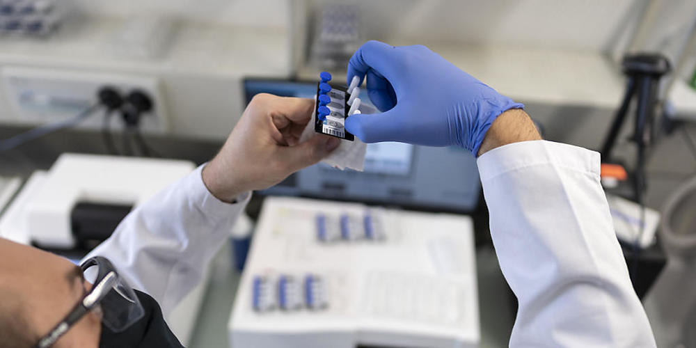 Dem Bundesamt für Gesundheit wurden am Dienstag 3150 neue Coronavirus-Ansteckungen innert 24 Stunden gemeldet. Ein Mitarbeiter des Wasserforschungsinstituts Eawag in Dübendorf bereitet Abwasserproben vor, um diese in einem digitalen PCR-Gerät auf ...