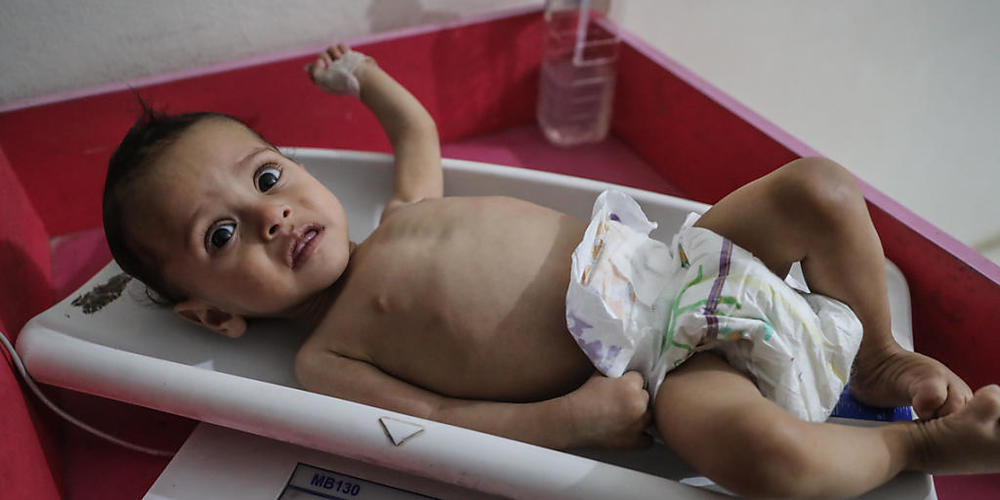 ARCHIV - Eine Krankenschwester ermittelt das Gewicht eines unterernährten Kindes im Ibn Sina Krankenhaus in Idlib. Am Freitag kann es möglicherweise zur Abstimmung über einen  UN-Resolutionsentwurf zur Versorgung von Millionen notleidenden Syrern ...