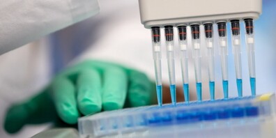 Es ist fraglich, wie lange die PCR-Tests noch gratis ausgewertet werden