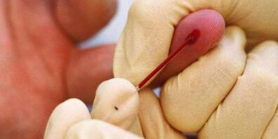 Knapp tausend Personen sind im Tessin auf Antikörper gegen das Coronavirus untersucht worden.