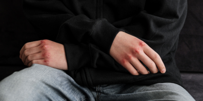 Die Erhebung von den «Hate Crimes» wird einen Beitrag zur Sensibilisierung der Bevölkerung beitragen.