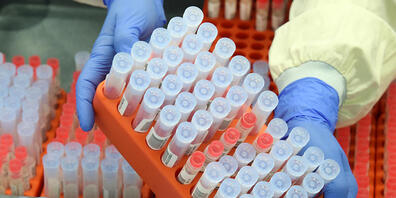 ARCHIV - Im MVZ Labor entnimmt die Leiterin der PCR-Abteilung, SARS-CoV-2-Proben aus dem Probenarchiv für Kontrollmessungen. Foto: Waltraud Grubitzsch/dpa-Zentralbild/dpa