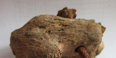 HANDOUT - Dieses undatierte Foto zeigt einen verrosteten Nagel, der in einem Knochenstück der Ferse steckt. Bei archäologischen Ausgrabungen im Dorf Fenstanton fand man die Skelettreste eines Mannes, der einen Nagel in der Ferse hat. Foto: Albion ...