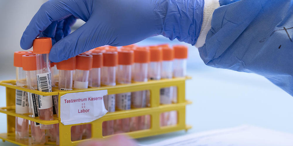 Corona-Proben werden in einem Labor verarbeitet. (Archivbild)