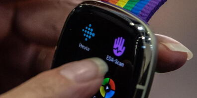 Fitbit ruft 1,7 Millionen Smartwatches zurück.