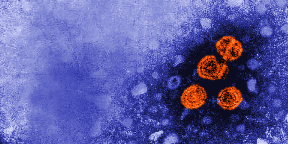 Hepatitis-B-Viren (rot) in einer Elektronenmikroskop-Aufnahme. (Archivbild)