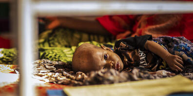 Rund 193 Millionen Menschen in 53 Ländern waren 2021 akut durch eine schlechte Ernährungslage gefährdet. Foto: Zerihun Sewunet/UNICEF/AP/dpa
