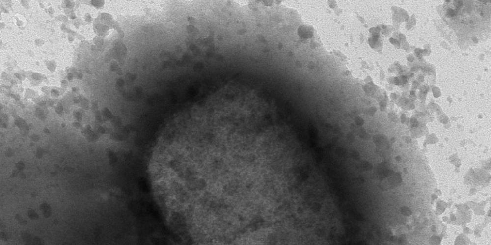 Eine elektronische Mikroskope-Aufnahme des Affenpocken-Virus. (Archivbild)