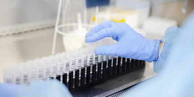 In der Schweiz und in Liechtenstein sind dem Bundesamt für Gesundheit am Dienstag innerhalb von sieben Tagen 10'289 neue Coronavirus-Ansteckungen gemeldet worden. (Symbolbild)