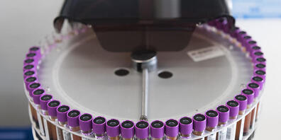 Labortarife sinken um zehn Prozent: Blutproben in einem Labor. (Archivbild)