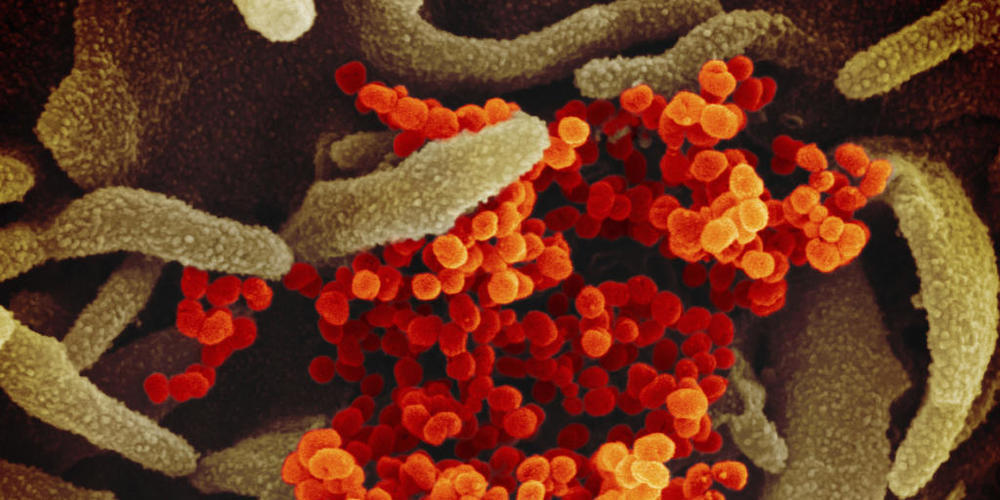 ARCHIV - HANDOUT - Eine undatierte elektronenmikroskopische Aufnahme des «U.S. National Institute of Health» zeigt das Coronavirus (SARS-CoV-2) (orange). Auf der Suche nach dem Ursprung des Coronavirus muss nach Meinung eines WHO-Expertenrates auc...