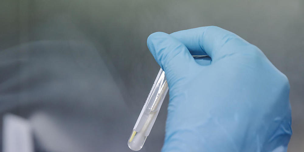 Eine Krankenschwester führt einen PCR-Test zur Erkennung des Affenpockenvirus durch. Die WHO will den Affenpocken einen neuen Namen geben.