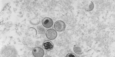 Elektronenmikroskopische Aufnahme von Affenpocken-Viren. In der Schweiz sind bis Montag 416 Fälle von Affenpocken aufgetreten. (Archivbilld)