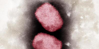 Das Affenpocken-Virus in einer elektronenmikroskopischen Aufnahme. Im Kanton Zürich wurde das Virus mittlerweile bei über 100 Personen festgestellt. (Archivbild)