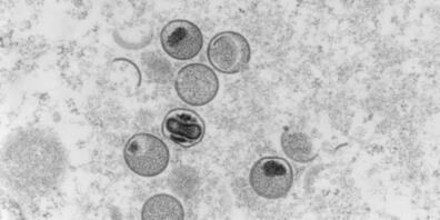 Für das Affenpocken-Virus wurde noch keinen neuen Namen gefunden, die Krankheit heisst laut WHO neuerdings Mpox. (Archivbild)