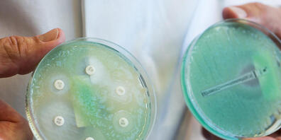 ARCHIV - Petrischalen mit sogenannten Krankenhauskeimen, die Mehrfachresistenzen gegenüber Antibiotika aufweisen. Foto: Armin Weigel/dpa