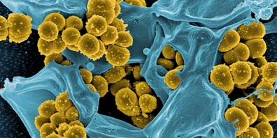 Antibiotika-resistente Staphylokokken (gelb) werden von einer weissen Blutzelle bekämpft (blau). Bild: Elektronenmikroskopie (NIAID), digital koloriert .