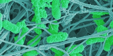Wundkeime (Pseudomonas aeruginosa, hellgrün) zwischen Bindegewebsfasern von menschlicher Haut (blau-grau) (Rasterlektronenmikroskopie, koloriert).