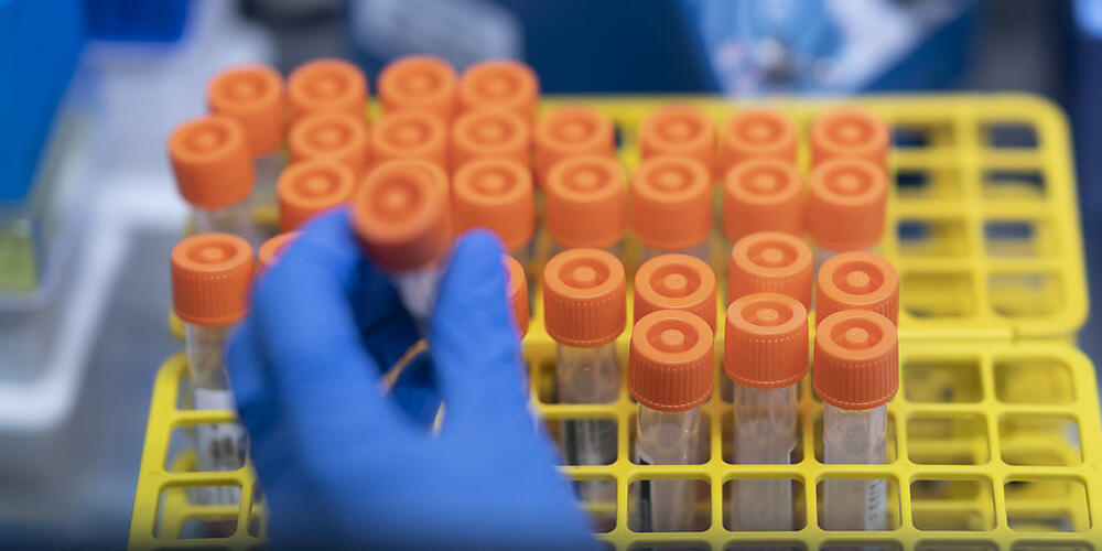 Bisher liessen sich rund 800 Zürcherinnen und Zürcher gratis auf Corona testen. Viele Infizierte dürften sich aber mit einem Selbsttest begnügen. Daher gibt es keine verlässlichen Infektionszahlen. (Symbolbild)