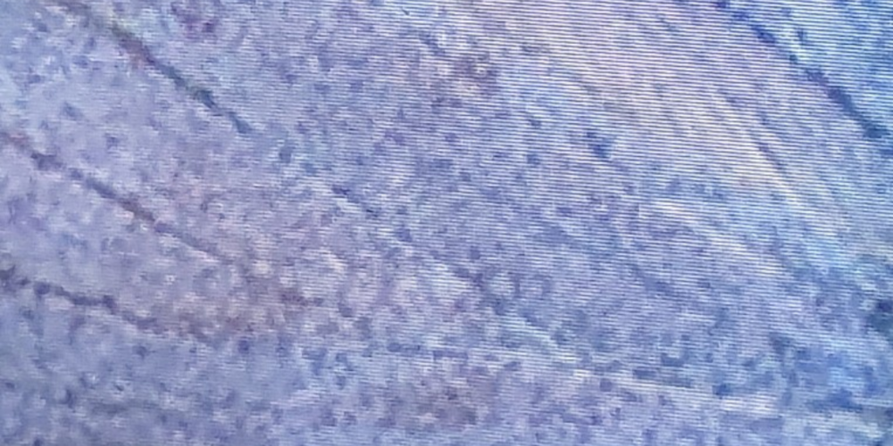 Die Jury kürte das Projekt von Ursula Palla zum Sieger, da «Ins Blaue» ein besonderes Werk ist, das hauptsächlich unsichtbar bleibt.