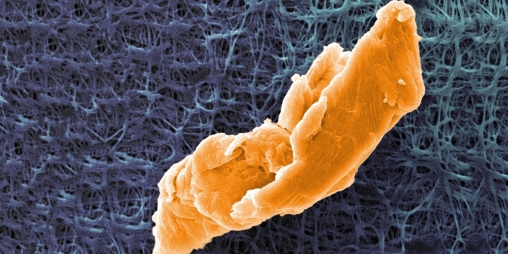 Rund 40 µm grosses Mikroplastikpartikel unter dem Rasterelektronenmikroskop (koloriert). 