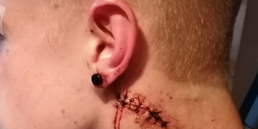 (Bild: Leser-Reporter)