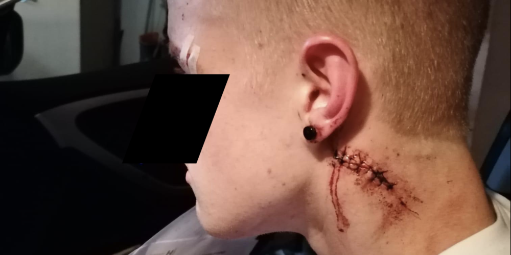 18-Jähriger: Nachdem er der Bitte nach Bargeld nicht nachgekommen sei, sei er von den Tätern mit Fäusten angegriffen und mit einem unbekannten Gegenstand verletzt worden. 