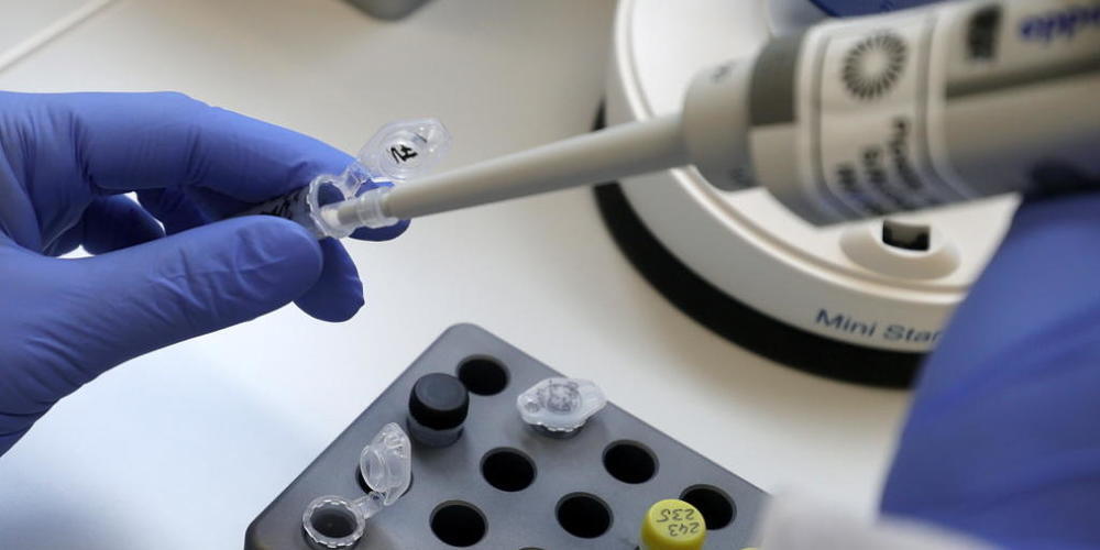 Auswertung eines Covid-19-Tests in einem Labor (Symbolbild: Keystone).