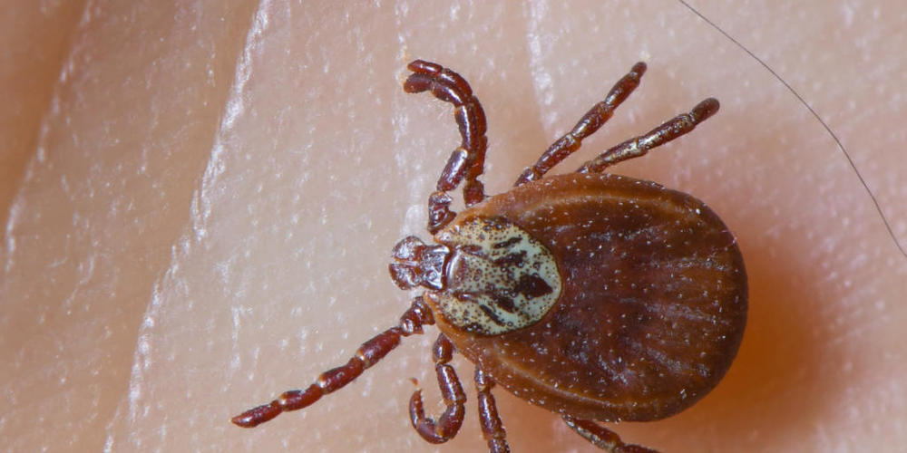 Zecken können verschiedene Krankheiten übertragen. (Archivbild)