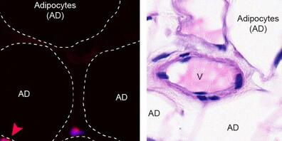 Berner Forschende konnten die verjüngende Wirkung von bestimmten Immunzellen im Bauchfett nachweisen. Hier ersichtlich sind die fördernden eosinophilen Zellen in menschlichem Bauchfett.