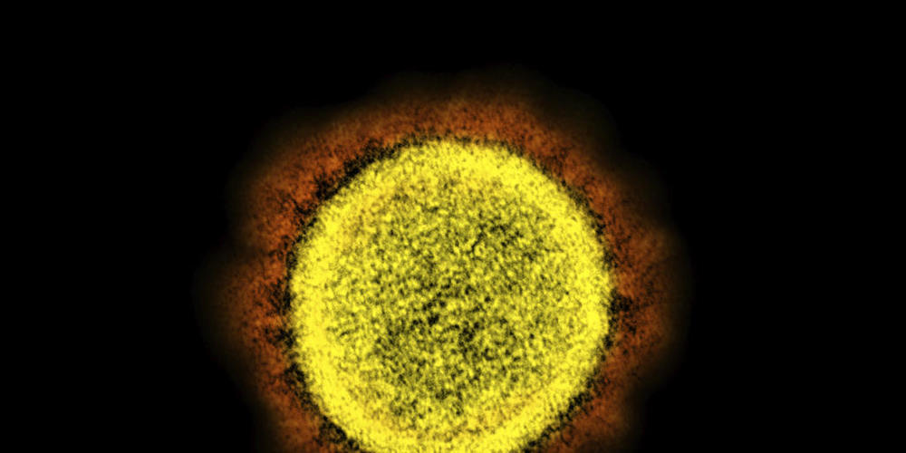 Mikroskopaufnahme des neuen Coronavirus Sars-CoV-2 (Archivbild Keystone).