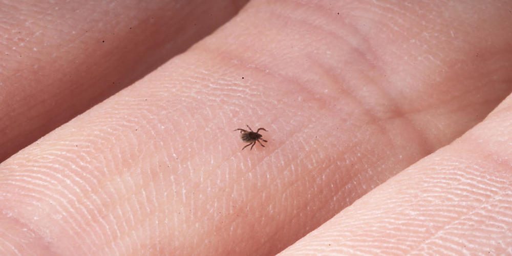 Zecken sind zwar nur kleine Tiere, ihre Stiche können aber grosse gesundheitliche Probleme verursachen. (KEYSTONE/Gaetan Bally)
