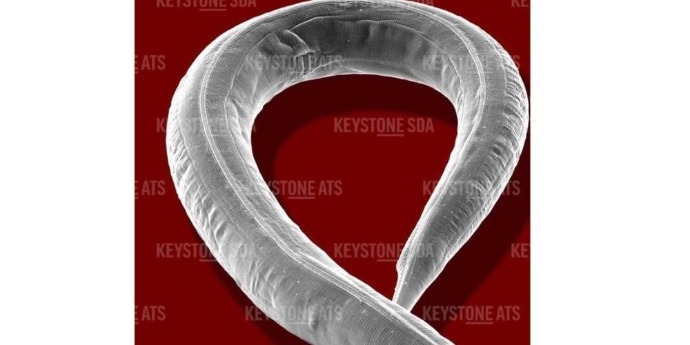 Dieser bescheidene Nematode (Fadenwurm) mit Namen Caenorhabditis elegans lehrt Forscher, wie man Komplexität reduziert. Sie haben nach seinem Vorbild ein Modell entwickelt, wie man die Unmengen an Anweisungen für Künstliche Intelligenz, beispielsw...
