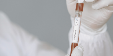 Schweizweit wurden in den letzten 24 Stunden 10'073 laborbestätigte Corona-Neuinfektionen gemeldet.