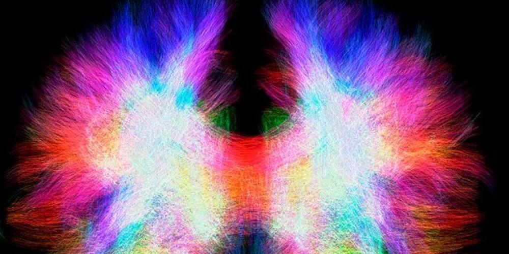 Das Corpus Callosum vermittelt die Signale zwischen den beiden Hirnhälften. Einigen Menschen fehlt dieser Balken, einige von ihnen kompensieren dies jedoch mit neuen Verbindungen in den einzelnen Gehirnhälften.