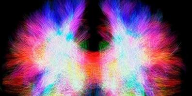 Das Corpus Callosum vermittelt die Signale zwischen den beiden Hirnhälften. Einigen Menschen fehlt dieser Balken, einige von ihnen kompensieren dies jedoch mit neuen Verbindungen in den einzelnen Gehirnhälften.