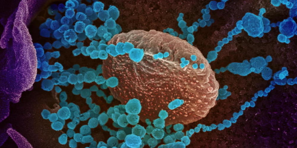 Eine Elektronenmikroskopische Aufnahme von SARS-CoV-2 (blaue Objekte): Forschende der Uni Bern haben im Labor untersucht, welche Wirkstoffe das Virus in Zellen hemmen. (Symbolbild)