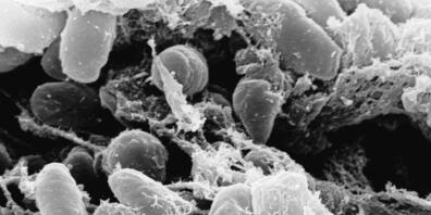 Eine Elektronenmikroskopaufnahme des Pesterregers Yersinia pestis. Forschende haben rekonstruiert, wie das Bakterium im 17. Jahrhundert in Venedig grassierte. (Archivbild)