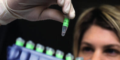 In der Forensischen Genetik am Institut für Rechtsmedizin der Universität Zürich werden DNA-Proben in Behältern aufbewahrt. Geht es nach dem Bundesrat, sollen künftig die Möglichkeiten der DNA-Analyse ausgeweitet werden. (Archivbild)