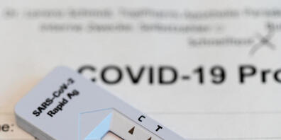 Ein positives Testresultat (zwei Streifen) auf dem Teststreifen eines Covid-19 Antigen-Schnelltests. (Archiv)