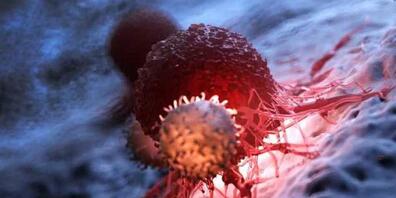 Tumore bestehen aus verschiedenen Zelltypen. Eine Schweizer Studie ist daran, diese im Einzelnen in noch nie dagewesener Detailtreue zu beschreiben. Ziel ist die personalisierte - und deshalb wirksamere - Krebstherapie. Bild: Im Vordergrund eine I...