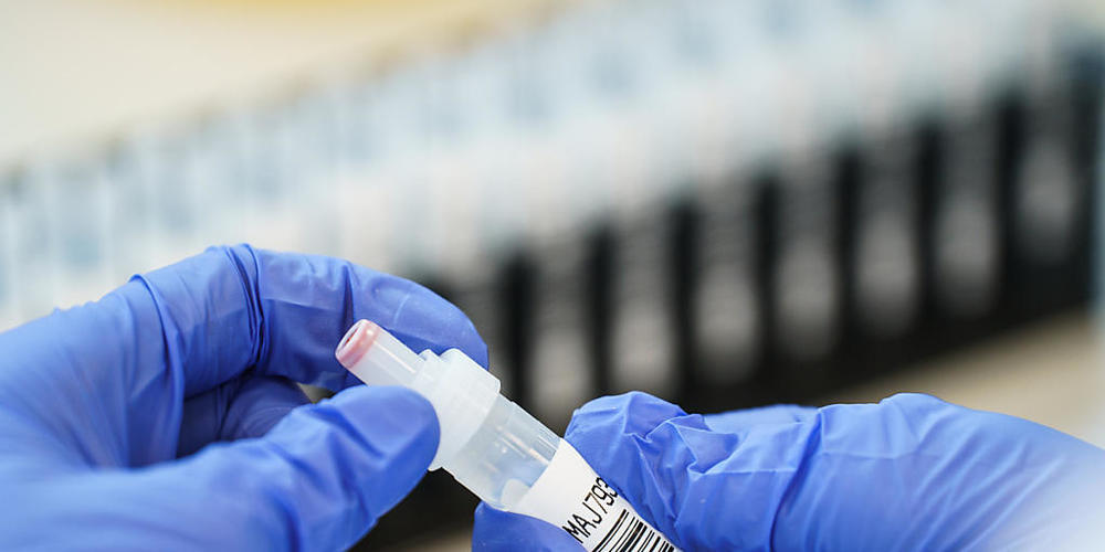 Britische Wissenschaftler sorgen sich wegen einer Mutation der zunächst in England entdeckten Variante des Coronavirus. Foto: Andreas Arnold/dpa