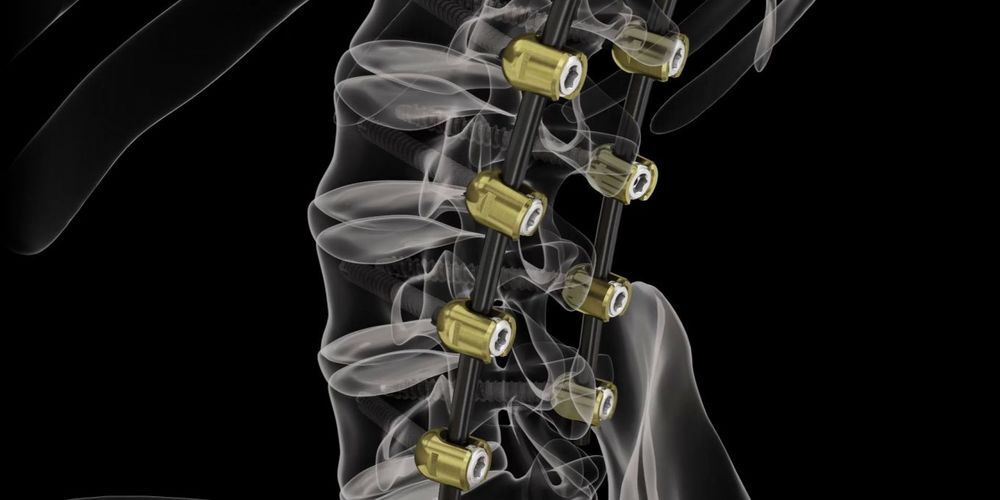 Bild: leaderdigital.ch