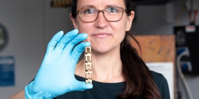 Empa-Forscherin Martina Cihova untersucht, wie der Körper die Oberfläche von Titanimplantaten angreifen kann. 
