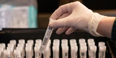 Im Glarnerland haben die Behörden mit den Corona-Flächentests begonnen. Getestet wird im Gesundheitswesen, an Schulen sowie in Betrieben.